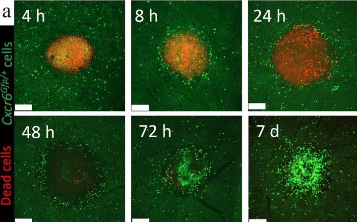 iNKT细胞在组织损伤修复中发挥关键作用